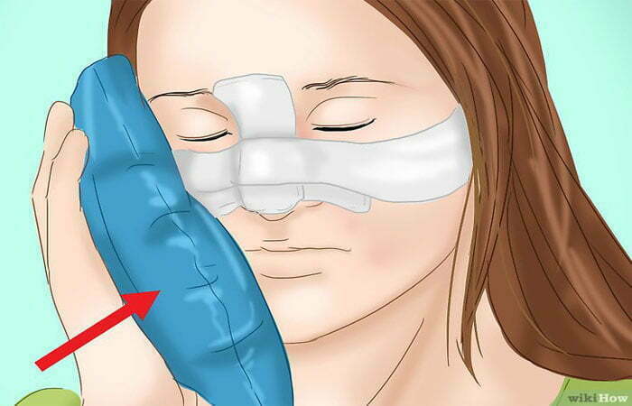 چکونه کبودی چشم پس از جراحی را کاهش دهیم؟