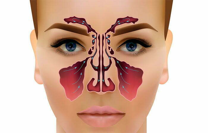 آندسکوپی سینوس بینی