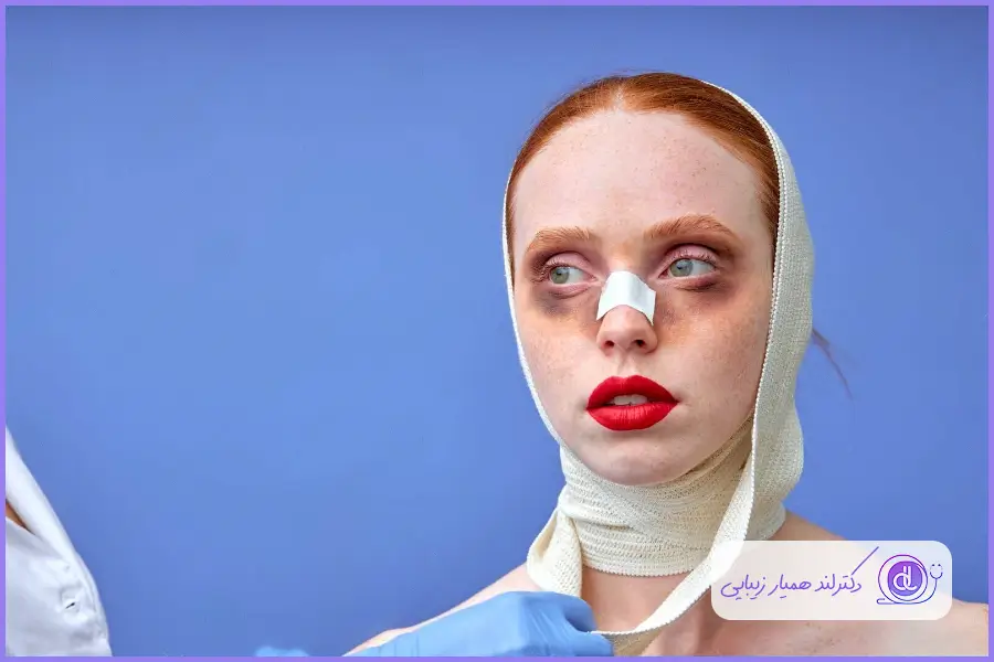 احتمال آسیب های جدی در راه رفتن بعد از جراحی بینی در صورت برخورد ضربه