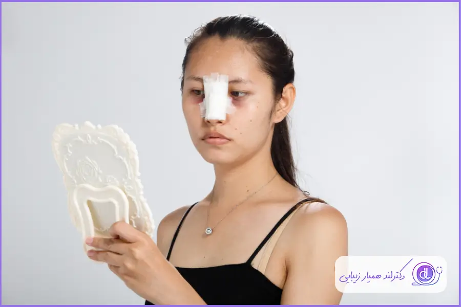 عوارض جراحی بینی بسته + 5 ترفند برای کاهش آن احتمال به جا ماندن جای چسب و آتل بینی یکی دیگر از عوارض عمل بینی بسته است
