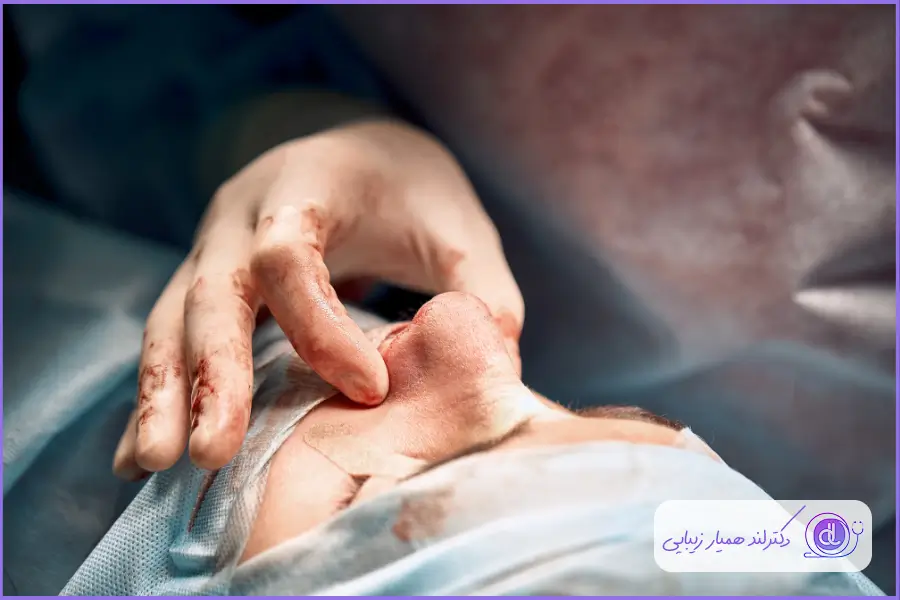 عوارض جراحی بینی بسته