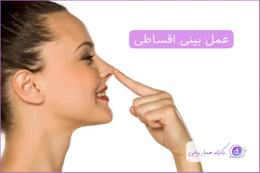 عمل بینی اقساطی