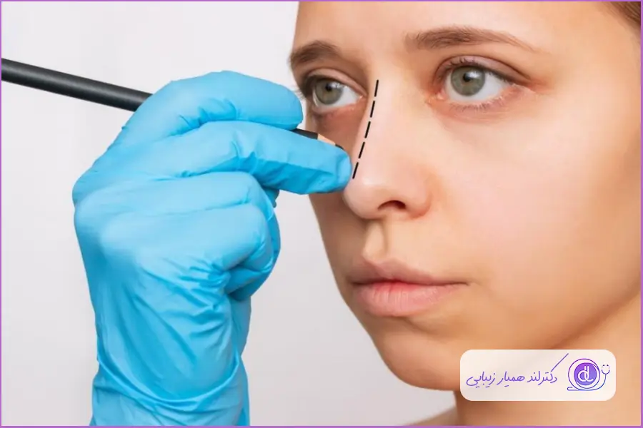 سوهان کشی بینی به چه صورت است؟