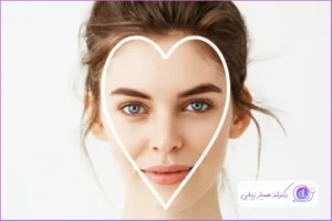 بهترین مدل عمل بینی