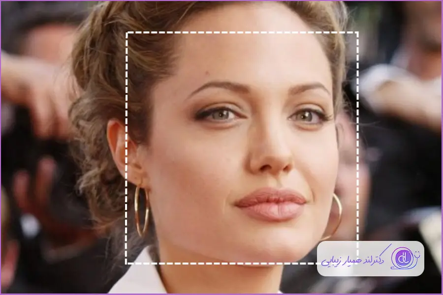 خصوصیات بینی ایده‌آل برای صورت مربع شکل