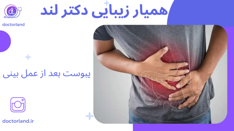 یبوست بعد از عمل بینی