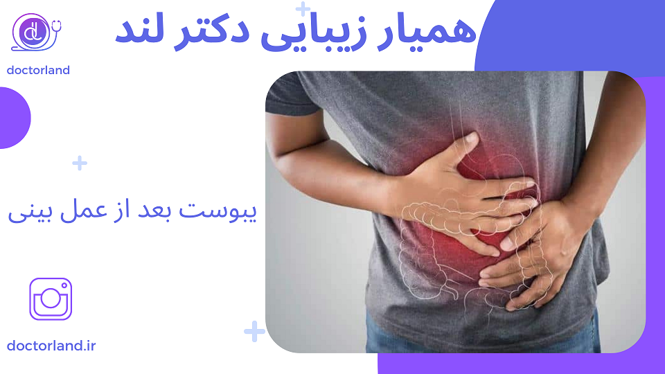 یبوست بعد از عمل بینی