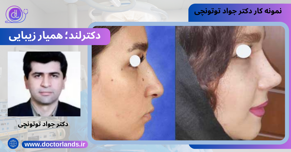 علائم همراه با نبض زدن بینی بعد از عمل بینی 