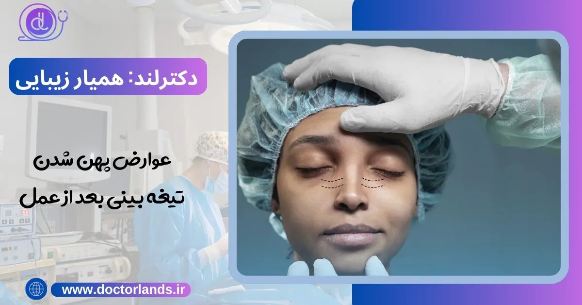علت پهن شدن بینی بعد از عمل + روش های درمان و پیشگیری عوارض پهن شدن تیغه بینی بعد از عمل
