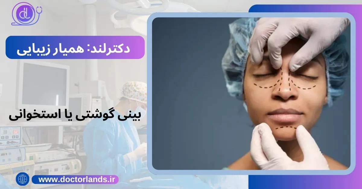 جراحی بینی چند ساعت طول میکشد و چه مدت بعد از عمل بینی مرخص میشویم. بینی گوشتی یا استخوانی