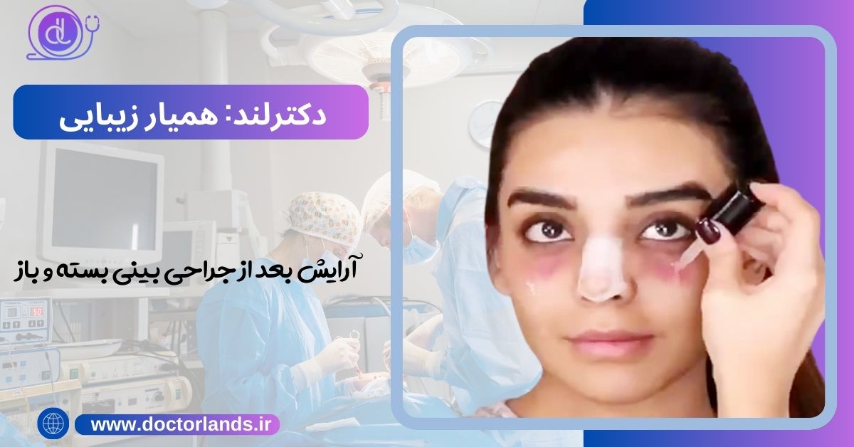 آرایش بعد از عمل بینی | چه مدت بعد از عمل بینی میتوان آرایش کرد؟