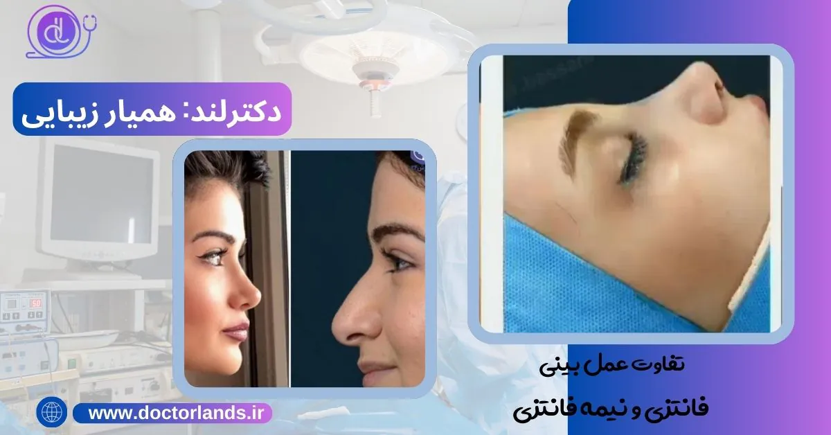 تمام نکات تفاوت عمل بینی فانتزی و نیمه فانتزی: کدام یک را انتخاب کنیم؟