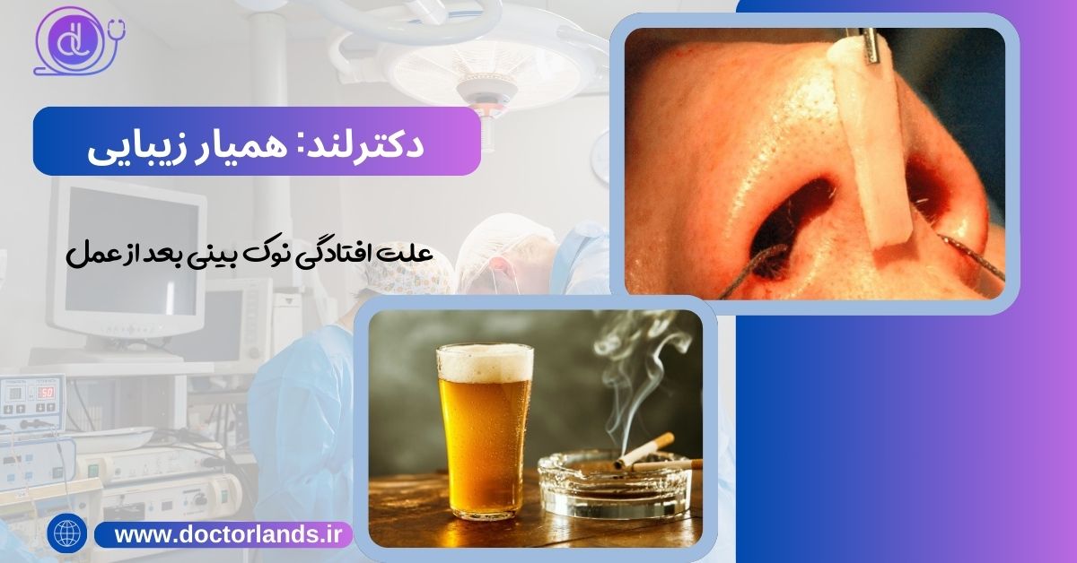 افتادن نوک بینی بعد از عمل جراحی | دلایل افتادگی نوک بینی