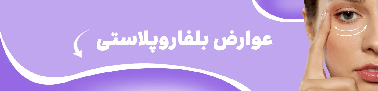 بلفاروپلاستی