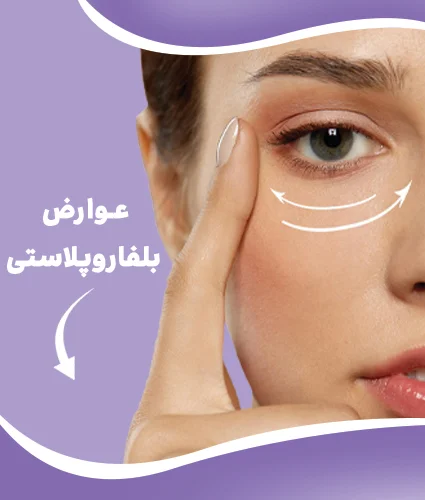 بلفاروپلاستی