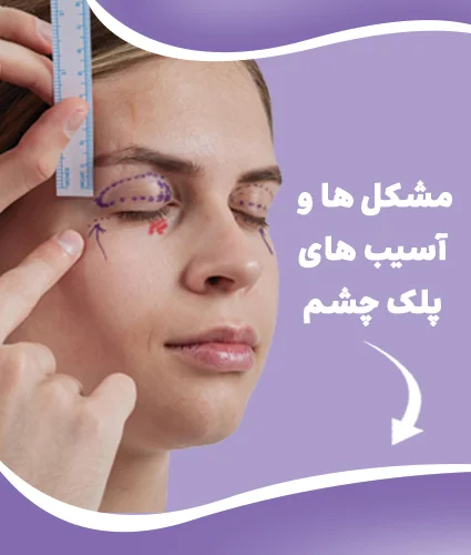بلفاروپلاستی
