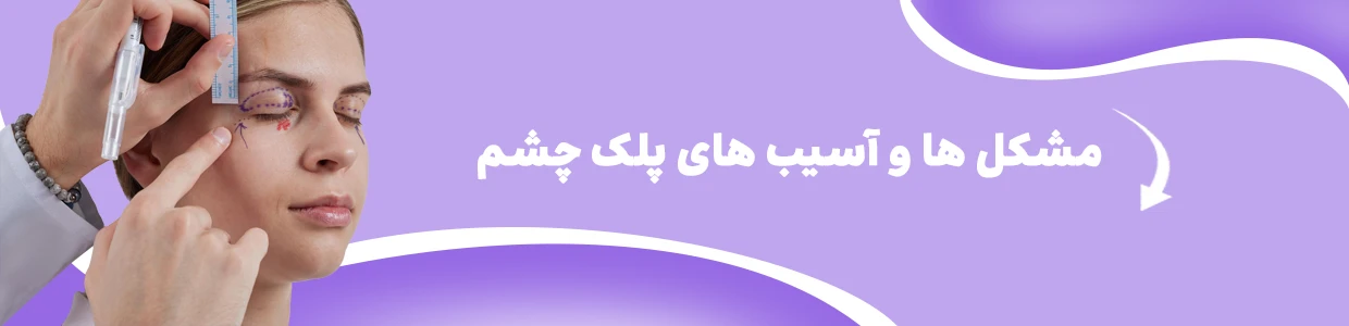 بلفاروپلاستی