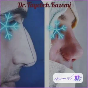 خشکی دهان بعد از عمل بینی