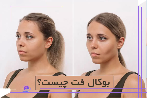عمل بوکال فت