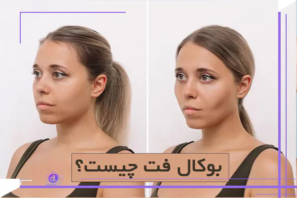 عمل بوکال فت