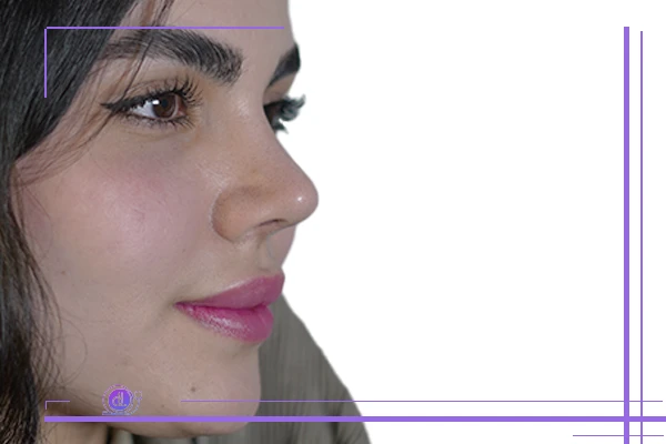 عمل بینی نیمه فانتزی