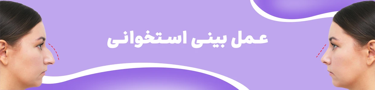 بعد از عمل بینی چی بخوریم: باید ها و نباید های تغذیه ای
