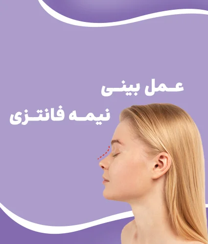 بعد از عمل بینی چی بخوریم: باید ها و نباید های تغذیه ای