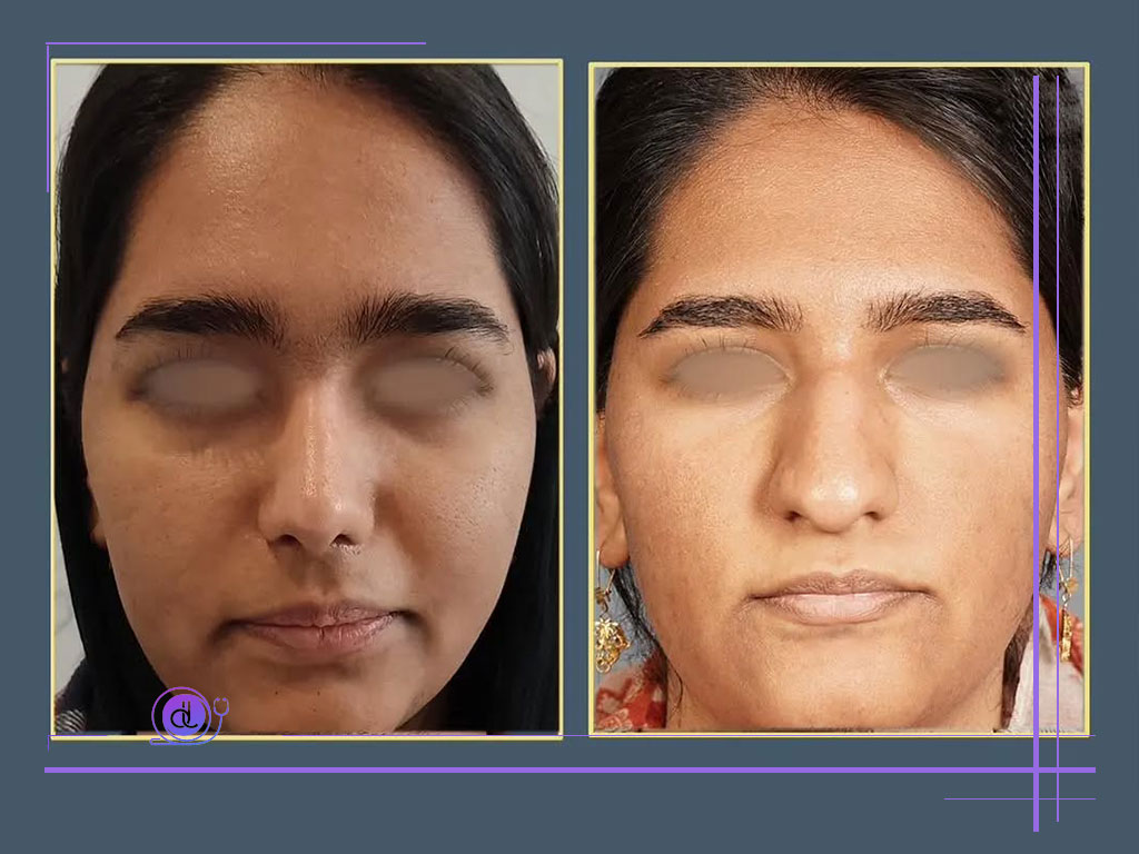 نمونه کار دکتر آزاده مرادی
