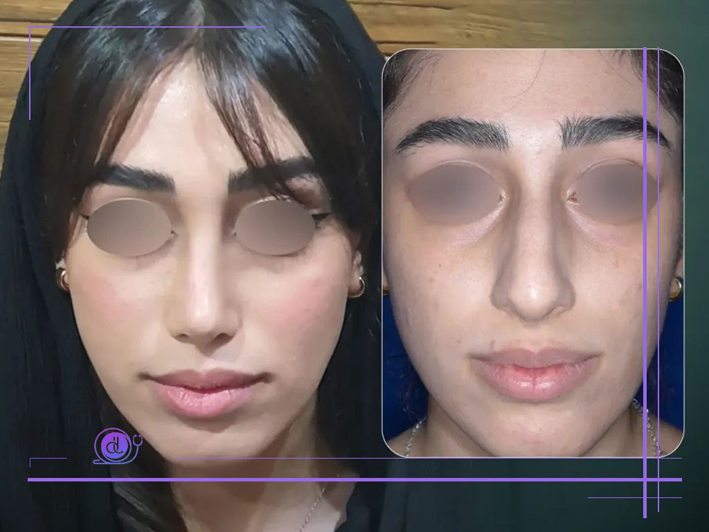نمونه کار دکتر رضا کبودخانی