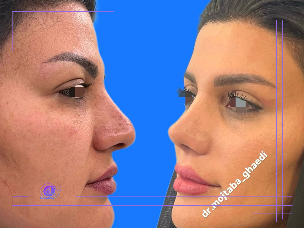 نمونه کار دکتر مجتبی قائدی