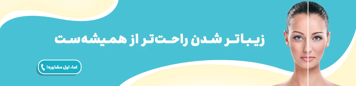 تزریق ژل و فیلر
