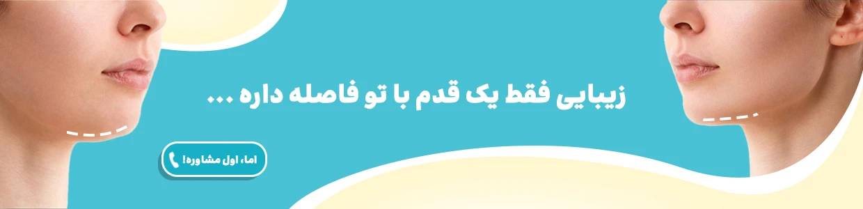جراحی غبغب