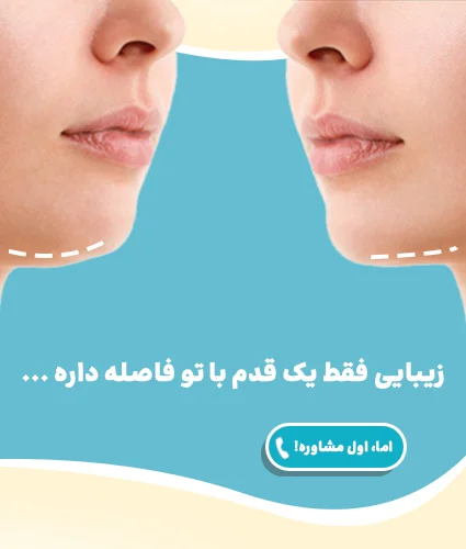 جراحی غبغب