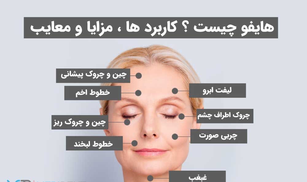 نواحی و مزایا و معایب هایفو