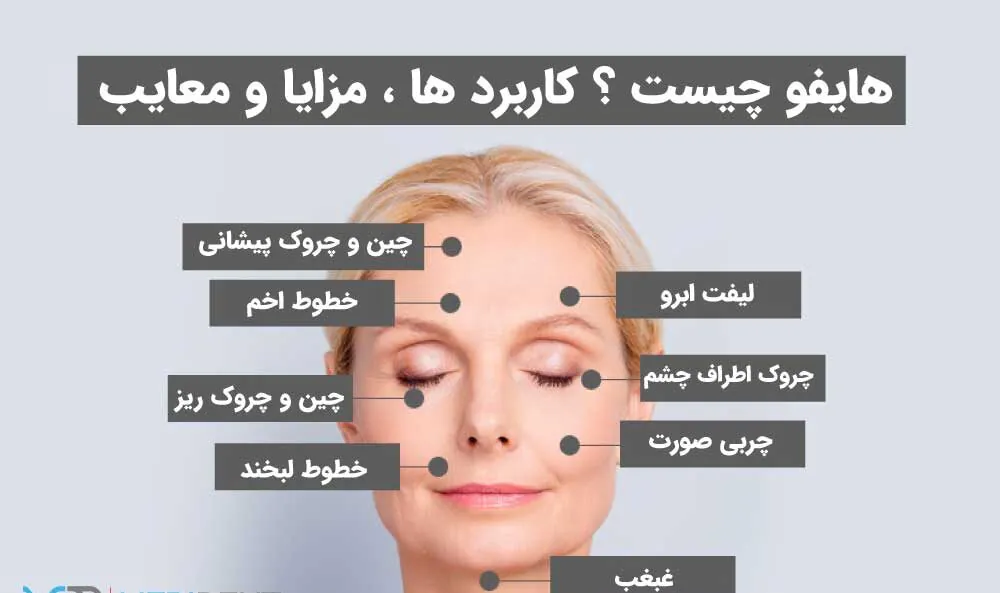 نواحی و مزایا و معایب هایفو