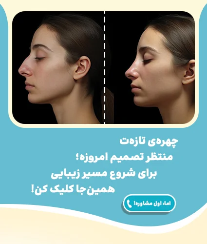 عمل بینی در قم و انتخاب بهترین جراح بینی