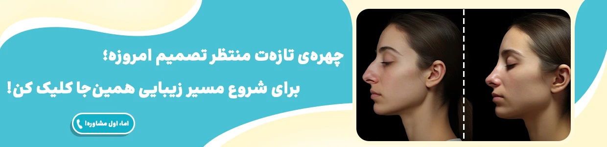 عمل بینی در قم و انتخاب بهترین جراح بینی