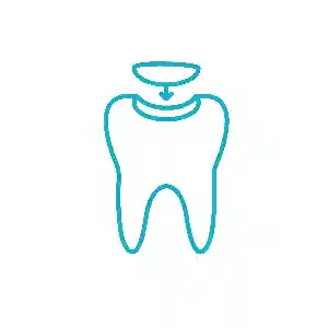 کامپوزیت دندان