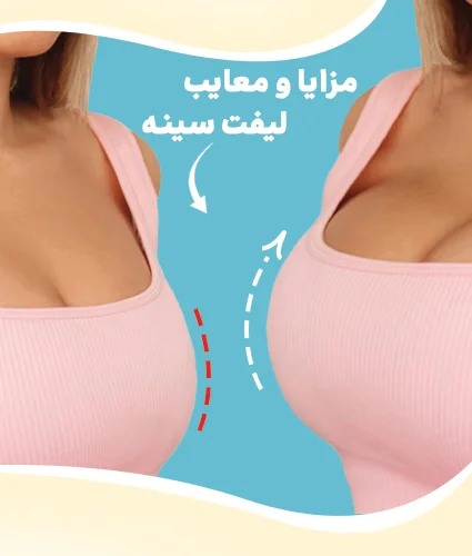 لیفت سینه