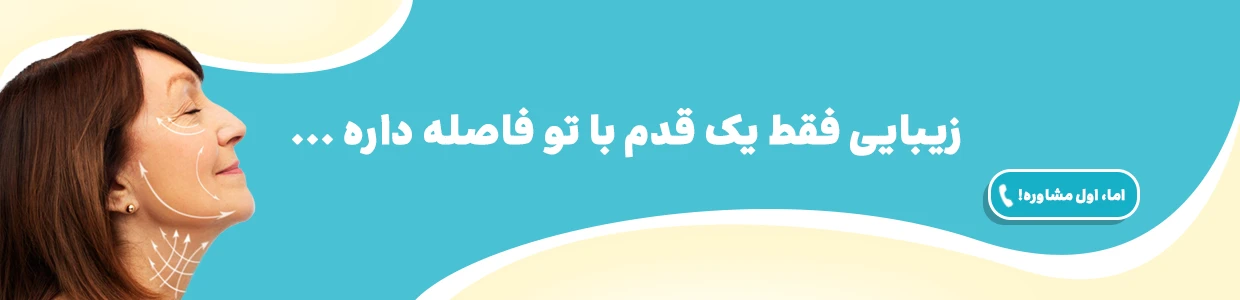 لیفت صورت
