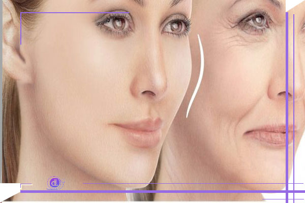 پروتز گونه چیست؟