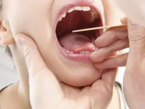 روش های جراحی لوزه: انواع عمل و راه کارهای آن