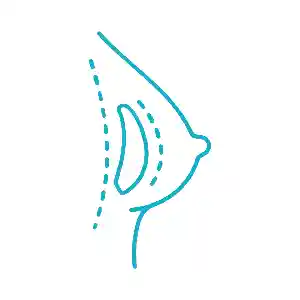 پروتز سینه