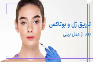 تزریق بوتاکس بعد از عمل بینی