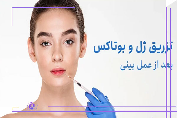 تزریق بوتاکس بعد از عمل بینی
