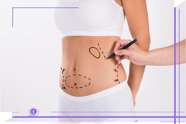مقایسه فیلر بدن با پیکرتراشی، پروتز و تزریق چربی؛ کدام روش بهتر است؟ فیلر بدن یا تزریق چربی