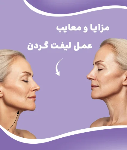 لیفت گردن