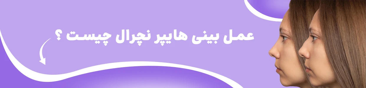 جراحی بینی