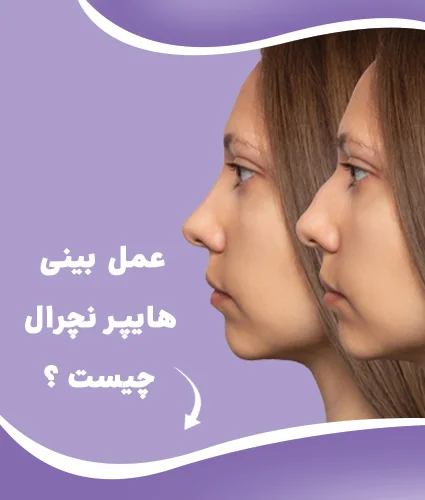 جراحی بینی
