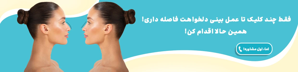 جراحی بینی